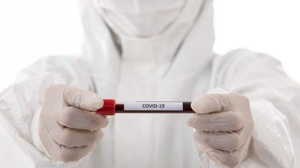 Vacina contra o coronavírus: Pfizer poderá produzir já em outubro de 2020
