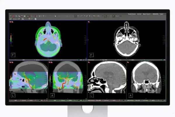 Studio Display XDR ganha suporte para Imagens Médicas DICOM
